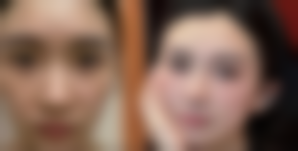 赵宏宇医生技术优势