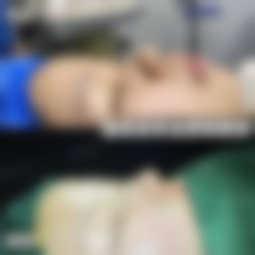 马鞍山瑞运达医疗美容诊所详细的预约挂号方式及流程