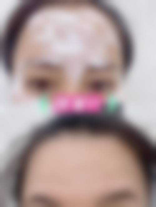 马鞍山瑞运达医疗美容诊所真人口碑评价怎么样？