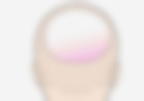 上海星媛·洁铭新加坡医美ClearSK(北外滩店)真实实例