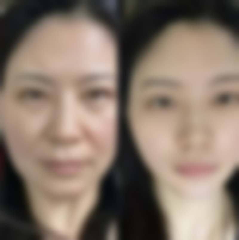 何文医生口碑评价及真人实例