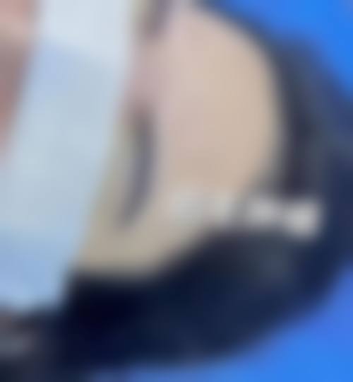 五、汕头爱丽诺苏国艺医疗美容医院特色项目及技术优势