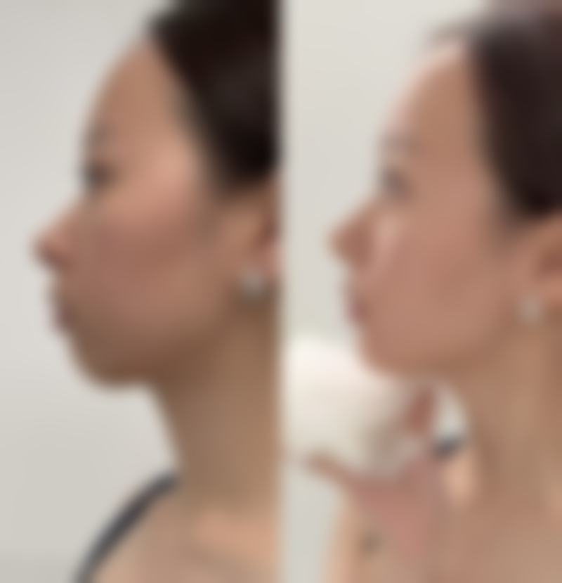 王晓菲医生口碑评价及真人实例