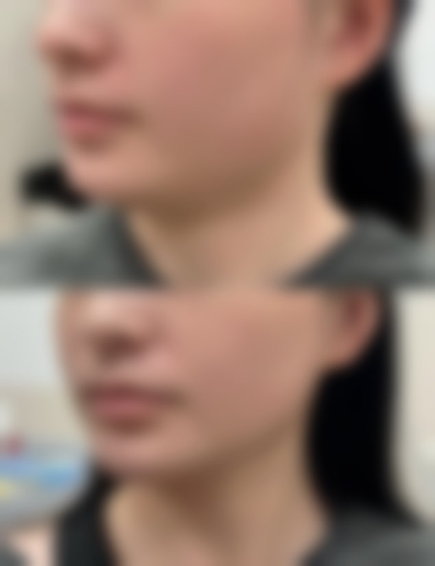 常州曼悦整形医院价目表