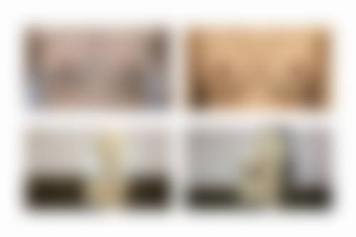 中南大学湘雅三医院烧伤整形科患者常见问题解答