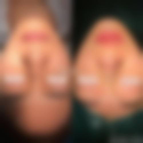 中南大学湘雅三医院烧伤整形科怎么样?