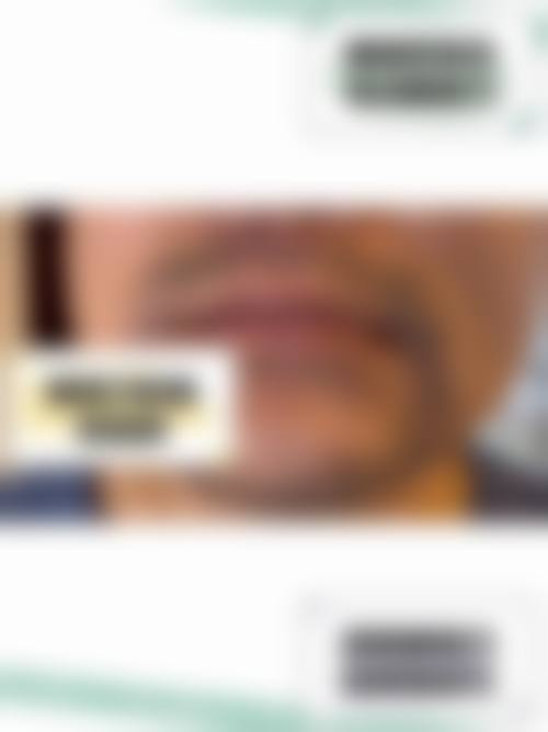 中南大学湘雅三医院烧伤整形科是国有的吗?