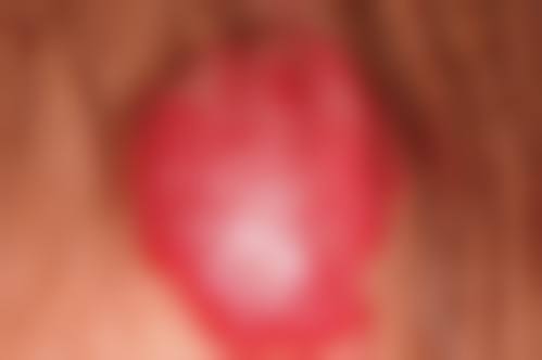 中南大学湘雅三医院烧伤整形科地址电话及来院路线