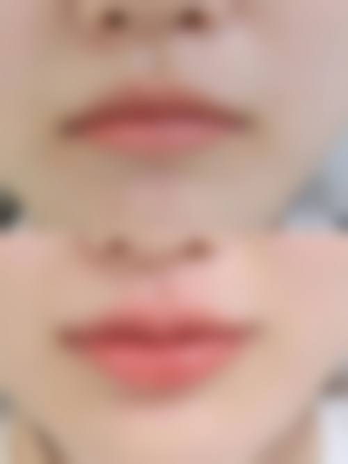 萍乡星悦医疗美容真实实例