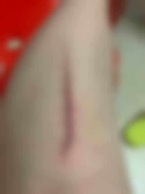 河北省中医院(医疗美容科)怎么样?