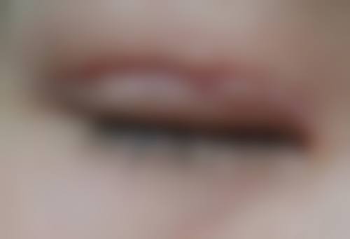 河北省中医院(医疗美容科)口碑如何?