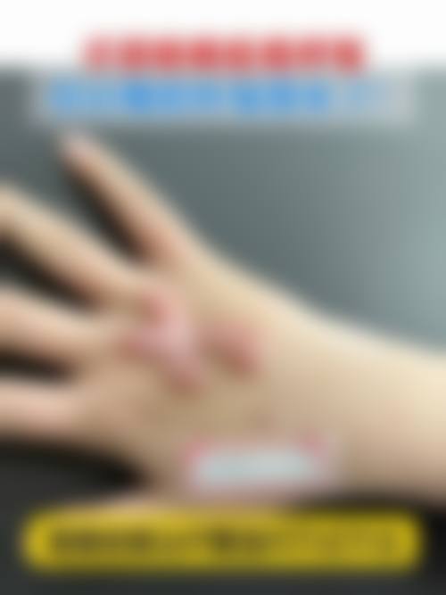 河北省中医院(医疗美容科)患者常见问题解答