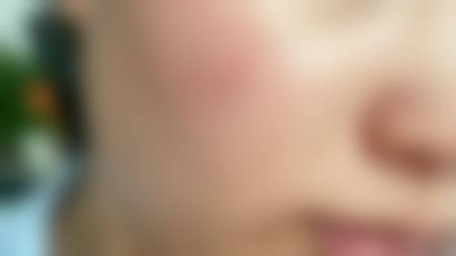 八、保定市莲池区瑞倪维儿美容医院价格表 / 收费区间参考