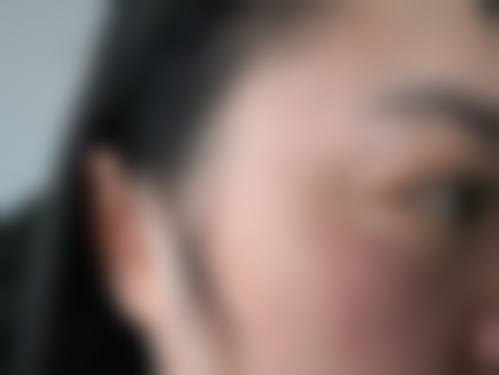 河北省中医院(医疗美容科)医院特色技术及优质服务