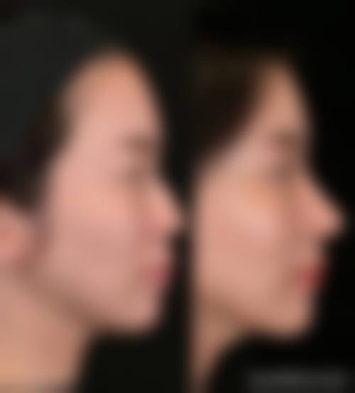 二、保定市莲池区瑞倪维儿美容医院是正规医院吗？正规资质查阅