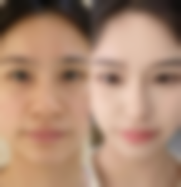 河北省中医院(医疗美容科)正规可靠吗?