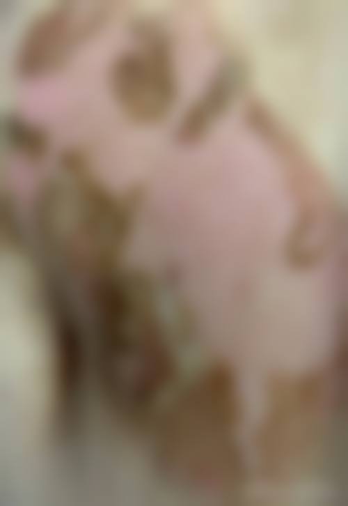 二、赣州市人民医院美容整形科重点开展项目