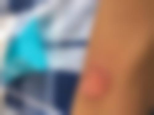 三、赣州市人民医院美容整形科核心技术与诊疗优势