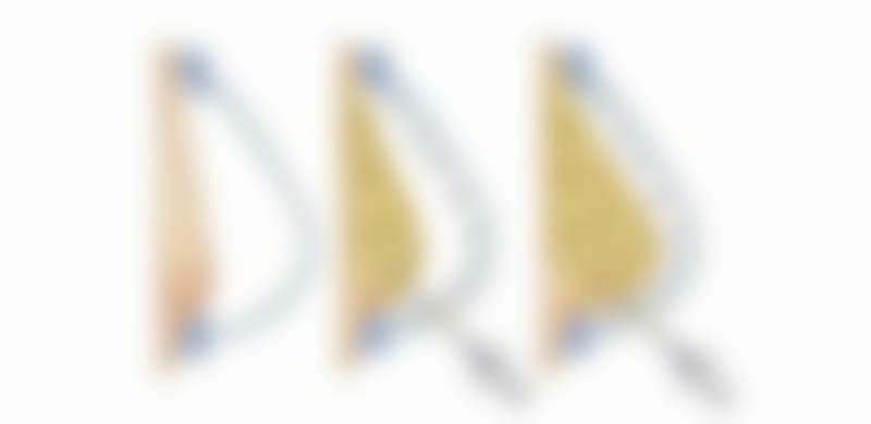 二、眼部整形修复项目