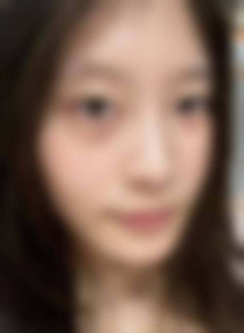 西安市第三人民医院医学整形美容中 心收费价格表/收费标准