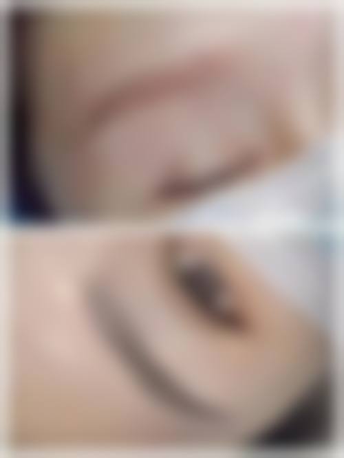 韩国微笑爱医院医院特色技术及优质服务