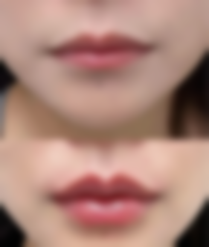 常德德丽锦医疗美容诊所真人口碑评价怎么样?