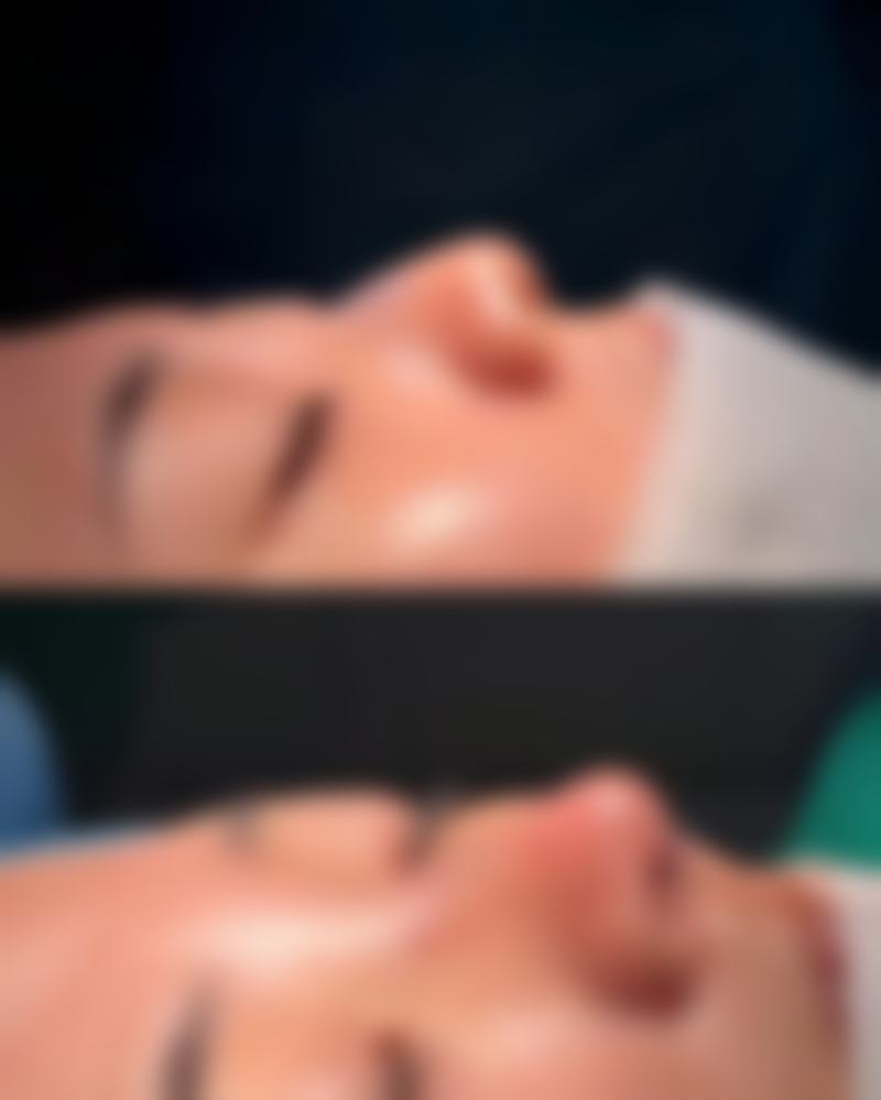 广州雅静美医疗美容诊所口碑如何？