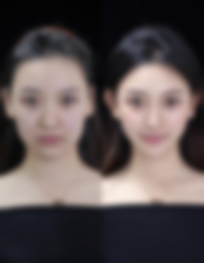 黄裕华医生口碑评价及真人实例