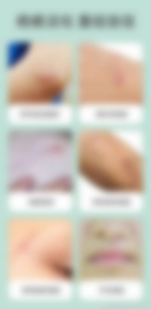 患者常见问题解答（精选）