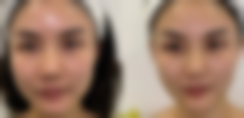 山东省立医院整形外科口碑好评反馈