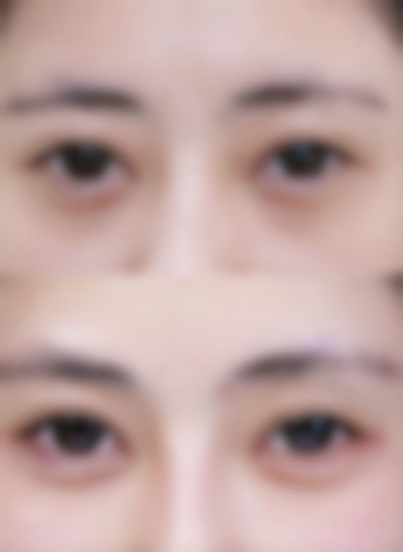 上海水芭蕾医疗美容医院收费价格表/收费标准