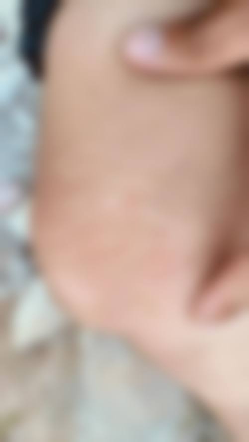 王屋金医生口碑评价及真人实例