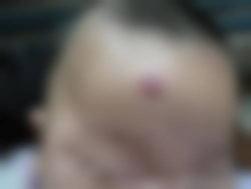 王屋金医生擅长项目