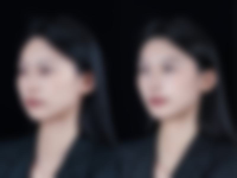 十、安康永秀医疗美容医院口碑与评价