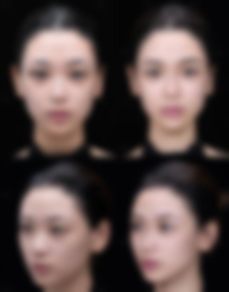 佛山第一人民医院烧伤整形科患者常见问题解答