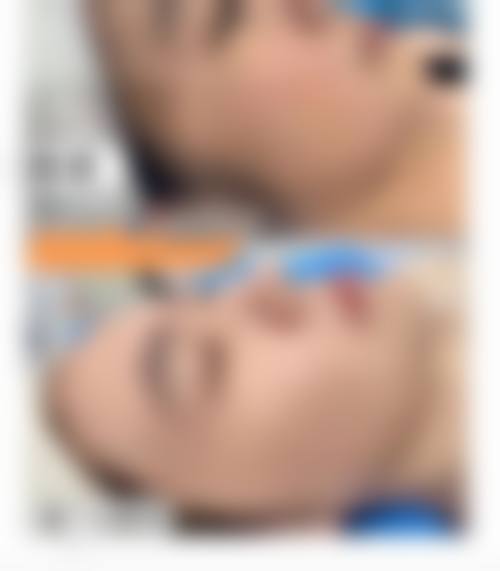 成都高新沁熹整形医院怎么样？