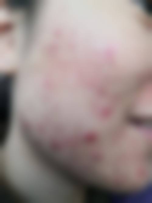 成都高新沁熹整形医院正规可靠吗？