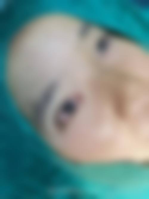 深圳弘美医疗美容整形医院正规可靠吗？