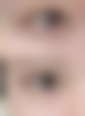 深圳弘美医疗美容整形医院地址电话及来院路线