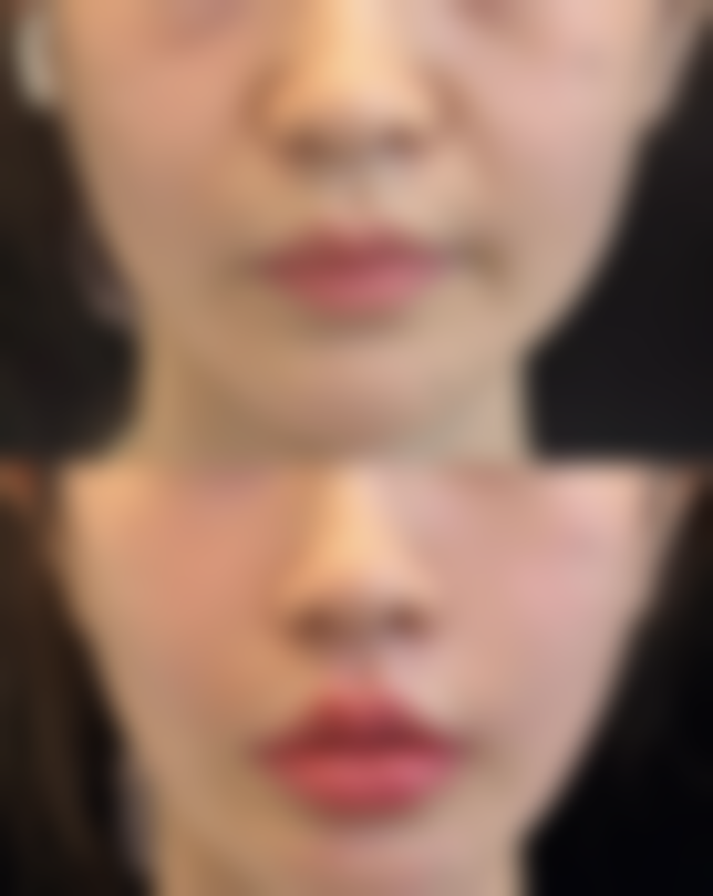 成都高新沁熹整形医院口碑如何？