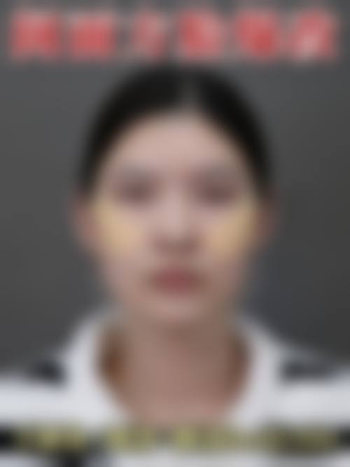 五、泰州碧昂卡医疗美容诊所真实实例参考