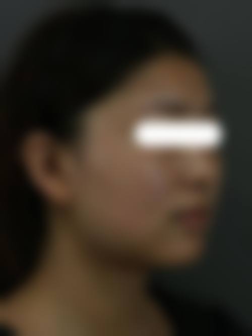 三、泰州碧昂卡医疗美容诊所核心技术与诊疗优势