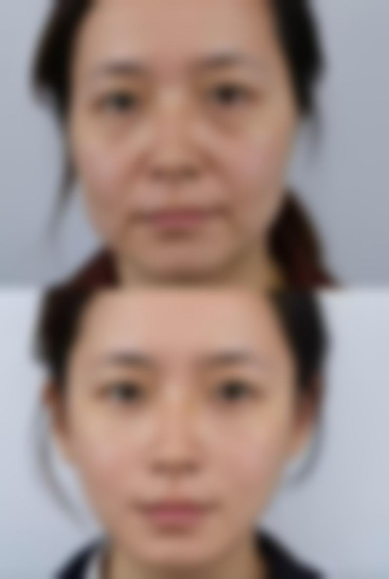 七、衡阳雅美晶肤医疗美容门诊部收费价格表/收费标准