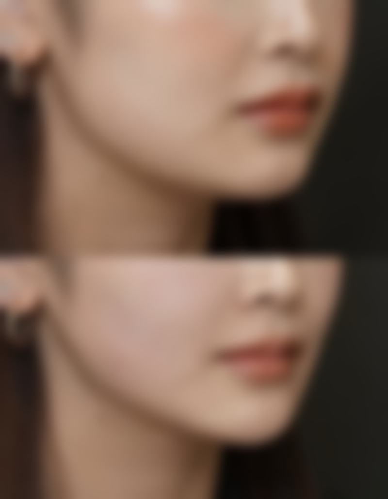 二、泰州碧昂卡医疗美容诊所重点开展项目