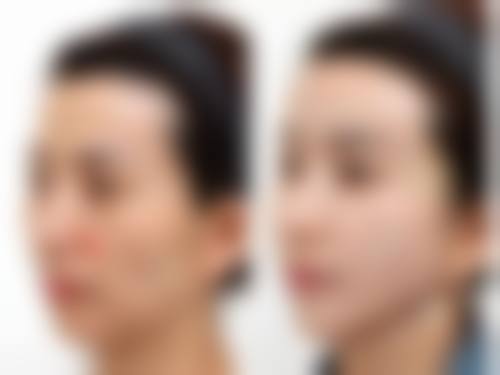 佛山市第一人民医院(整形美容二科)重点项目解析