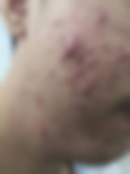 合肥童颜堂整形医疗美容医院如何预约?