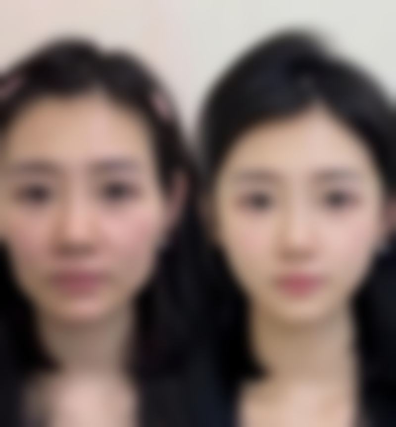 宿迁奕美美容医院详细的预约挂号方式及流程