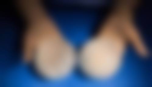 长沙芊丽医疗美容门诊部收费贵吗？