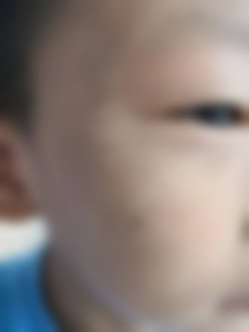 青岛大学附属医院(医学美容科)预约挂号：多渠道便捷流程