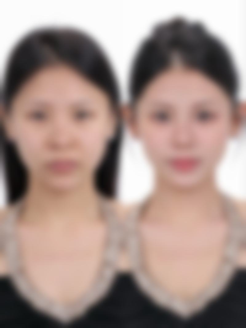 韩国韩美人皮肤科医院开展项目范围